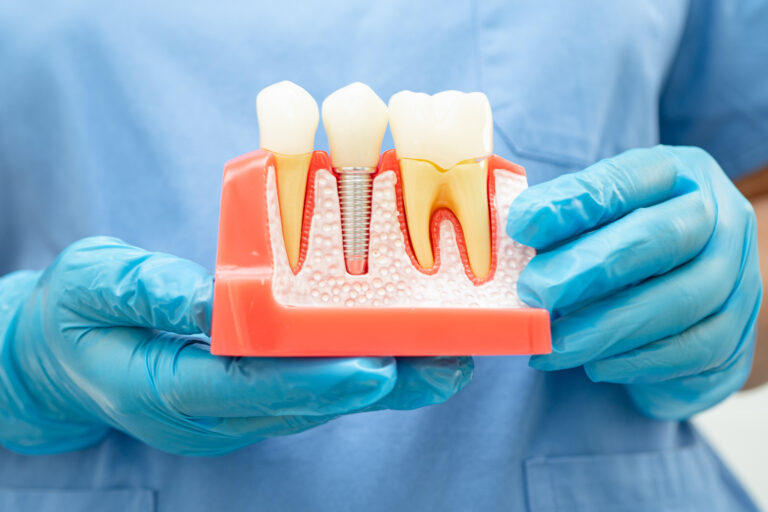 best root canal treatment