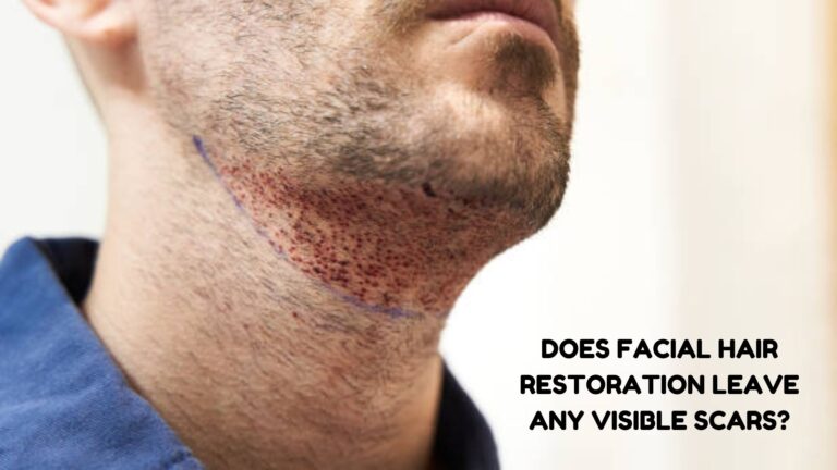 facial hair restoration