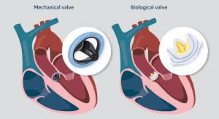 valve image